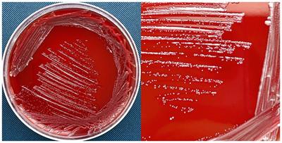 Genomic analysis of multidrug-resistant Delftia tsuruhatensis isolated from raw bovine milk
